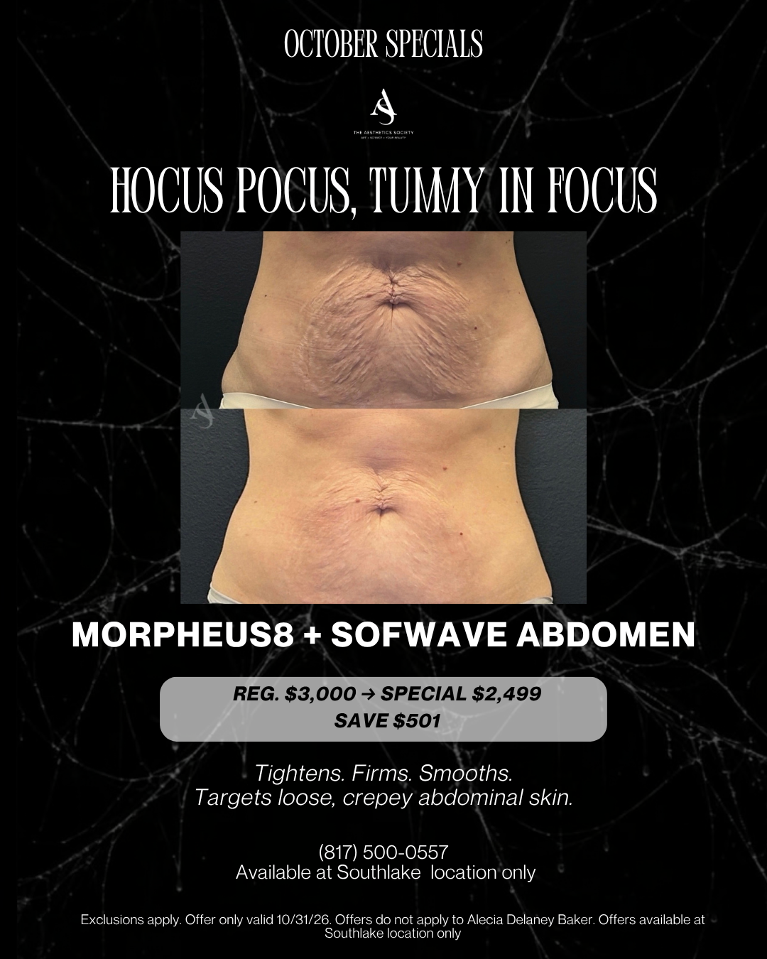 October Special: Morpheus8 + Sofwave Abdomen