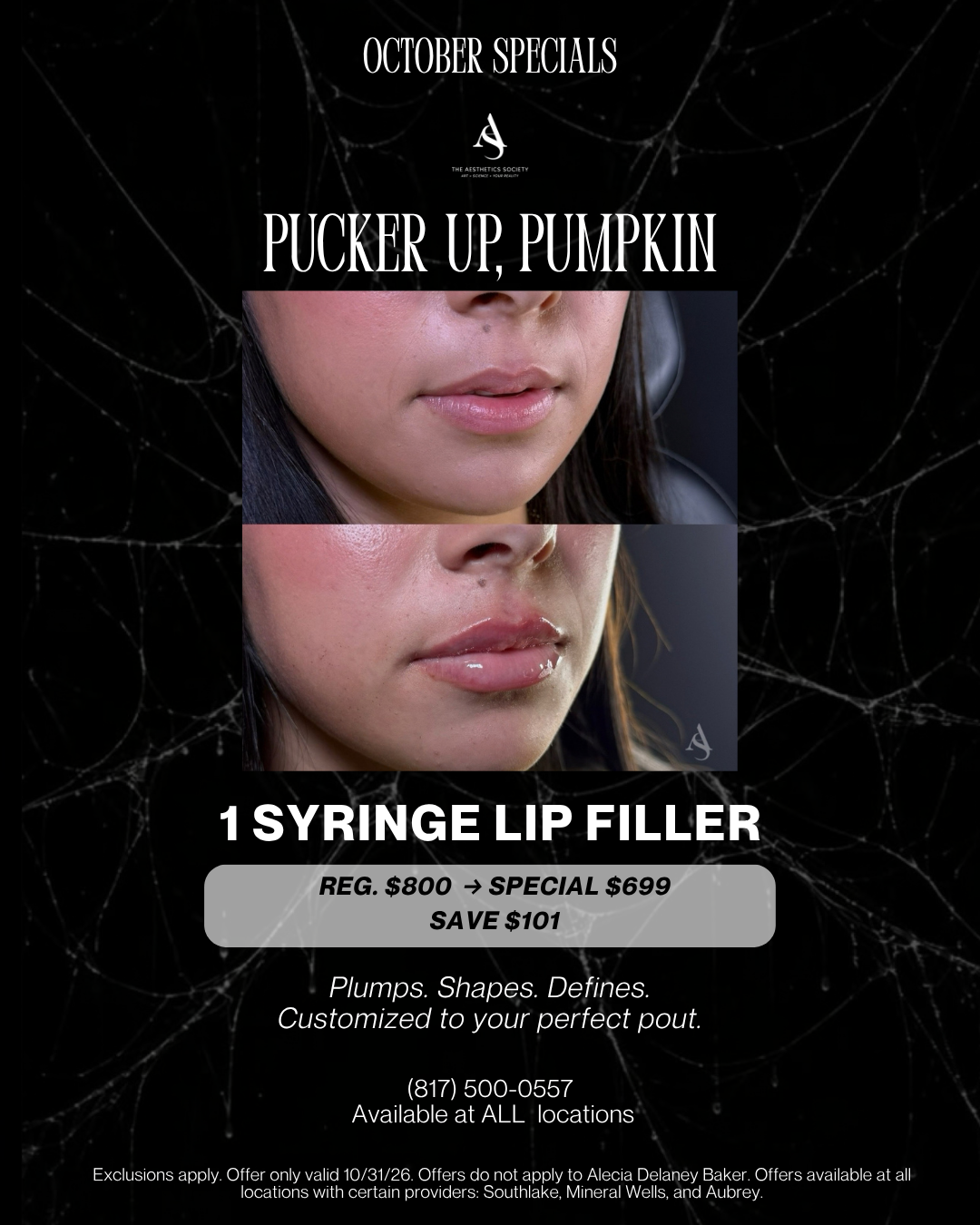 October Special: Lip Filler