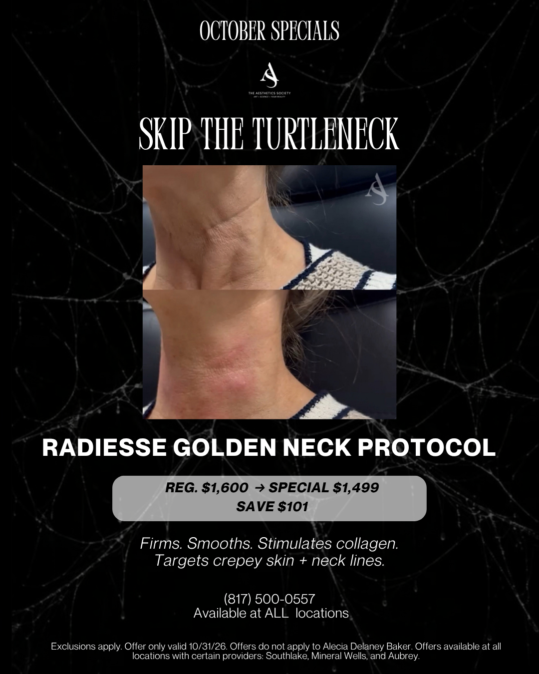 October Special: Radiesse Golden Neck Protocol