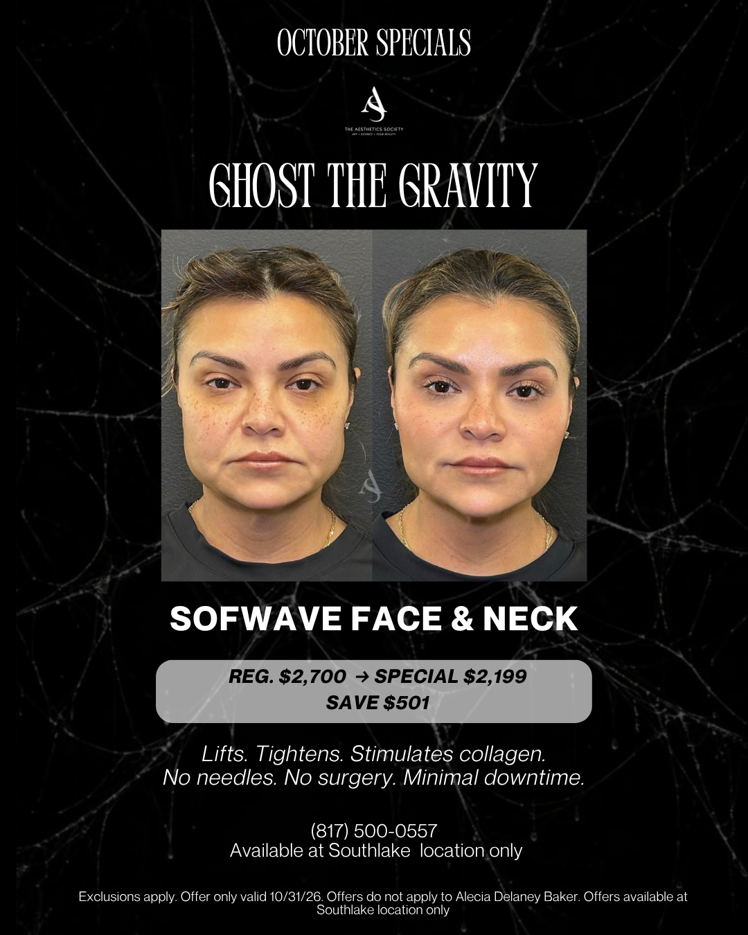October Special: Sofwave Face & Neck